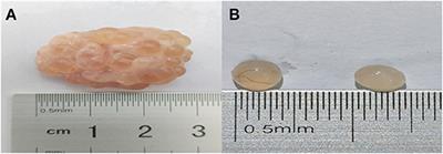 Non-targeted Metabolomics Reveals Metabolic Characteristics of Porcine Atretic Follicles